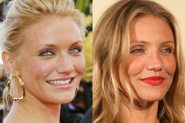 Cameron Diaz before and after nose job plastic surgery.