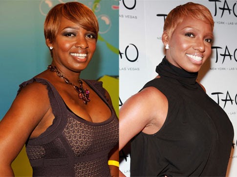 Nene Leakes before and after nose job plastic surgery. 