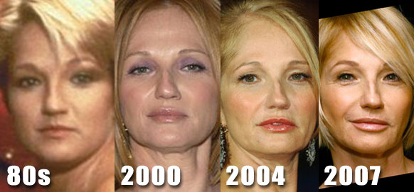 ellen-barkin-before-after.jpg