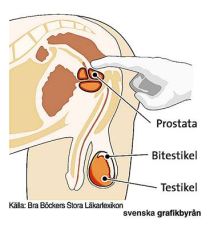 [PROSTATAN.jpg]