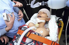 آخر مستجدات مذبحة غزة الثانية