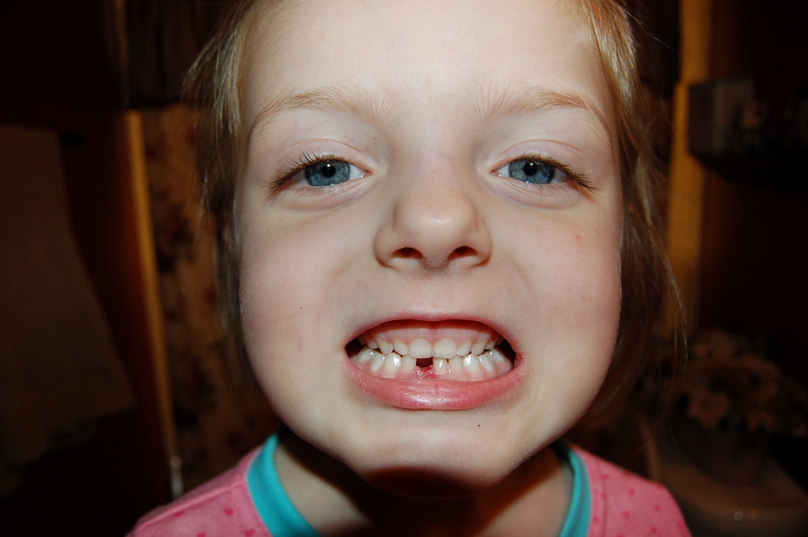 [053109+1st+lost+tooth002.JPG]