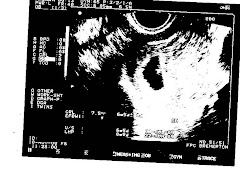 1st. Ultrasound