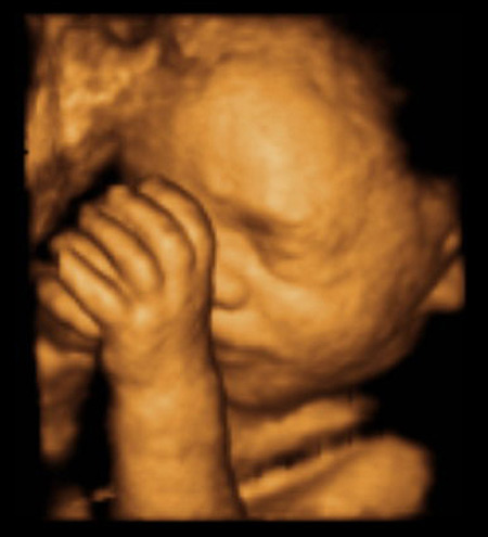 [the-fetus-project-by-jorge-lopes-dos-santos-17.jpg]