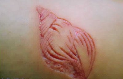 [Scarification_39.jpg]