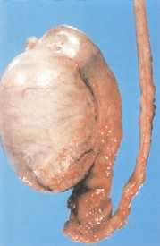 testiculo2.jpg