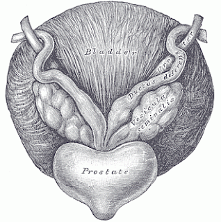 febră prostatită cronică