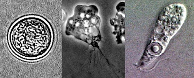 MPH 720 Global Environmental Health Issues: Naegleria fowleri