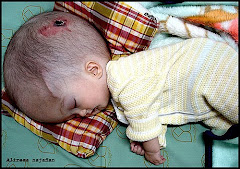 Baby with hydrocephalus