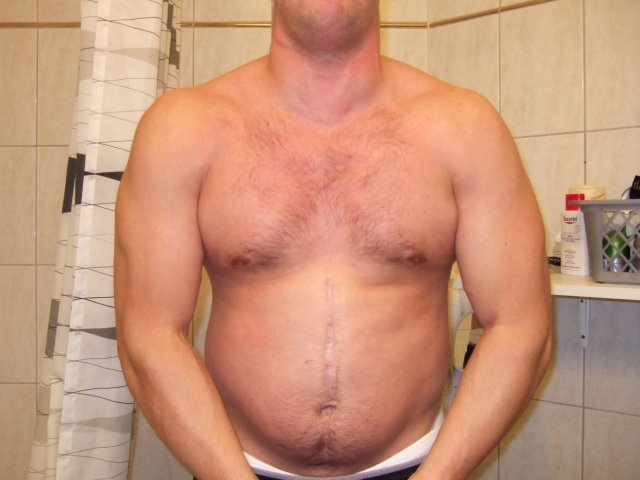 Johan — Before Leangains @ 230lbs (Front)