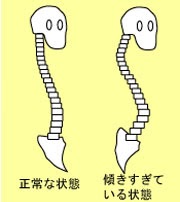 ライダーは周回遅れ 仙骨を立てる