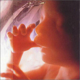 http://4.bp.blogspot.com/_e5k3OrkhpyY/SRJmBa0qd5I/AAAAAAAAAWE/bsBckLCLAUY/s400/mg+16+aa.jpg