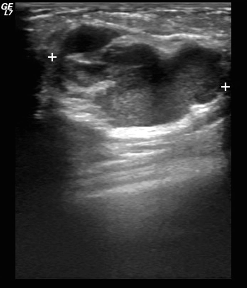 My E-Radiology Cases Case 145  30 Year-Old Women With -1614