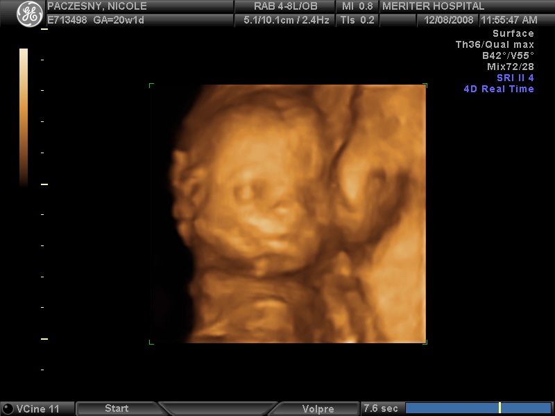 [20WKS_12.JPG]
