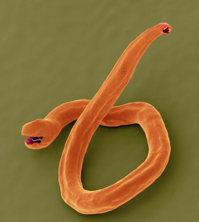 CFZ Daily News After the girl's nostril leech More nasty animals