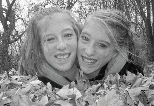 Can twins abby and brittany hensel Twins abby and brittany hensel