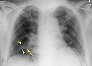 RiT radiology: June 2010