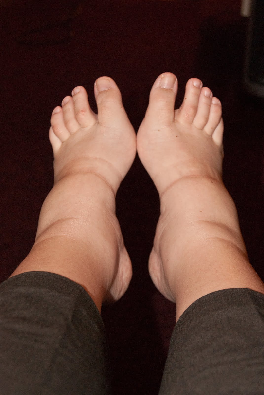 a JoURnEy tO foRevEr Sausage Feet