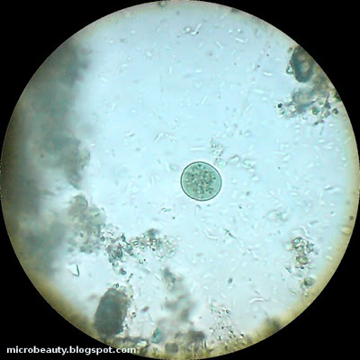 Round shaped microorganism.