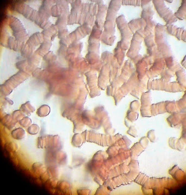 Red Blood Cells Magnified to 750 Times