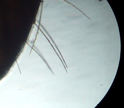 Ant's Hair