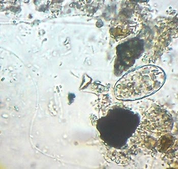 Micro Organisms living in the water