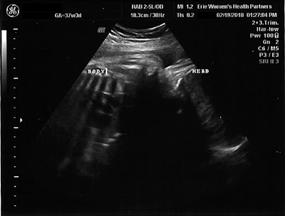 Rachel & Brian's Family Blog: 37.5 Week Appt & Sonogram... + Papa