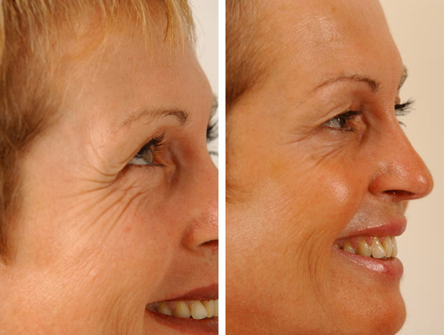 [kırışıklıklar.jpg]