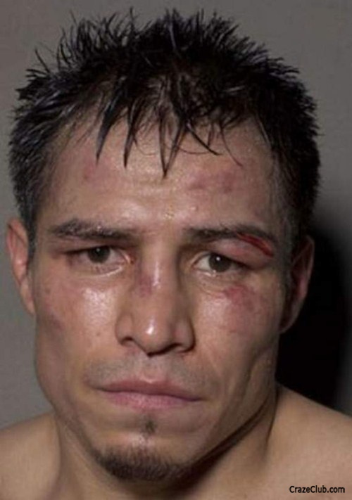 Boxers Before and After the Fight