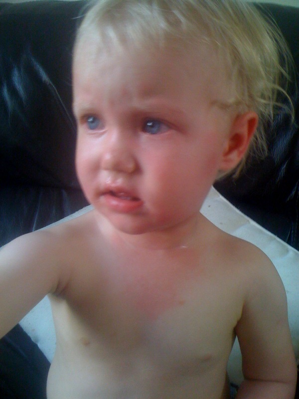 Adventures of The Pricey's Allergy Kid