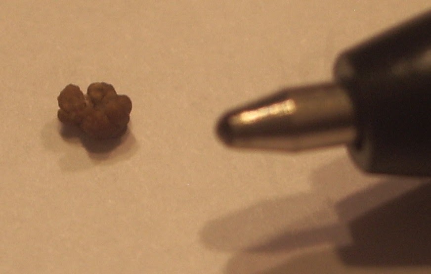 Wild Fiction Kidney Stone