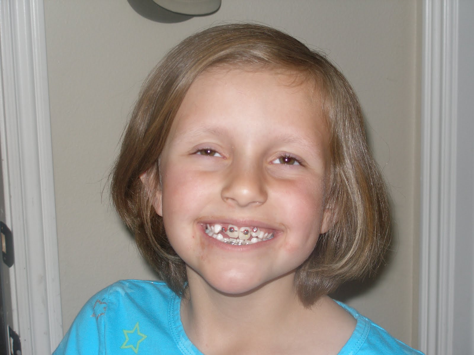 Utah Girls Lindsey gets braces