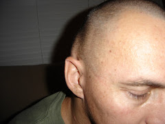 The Soft Swelling on the Incision