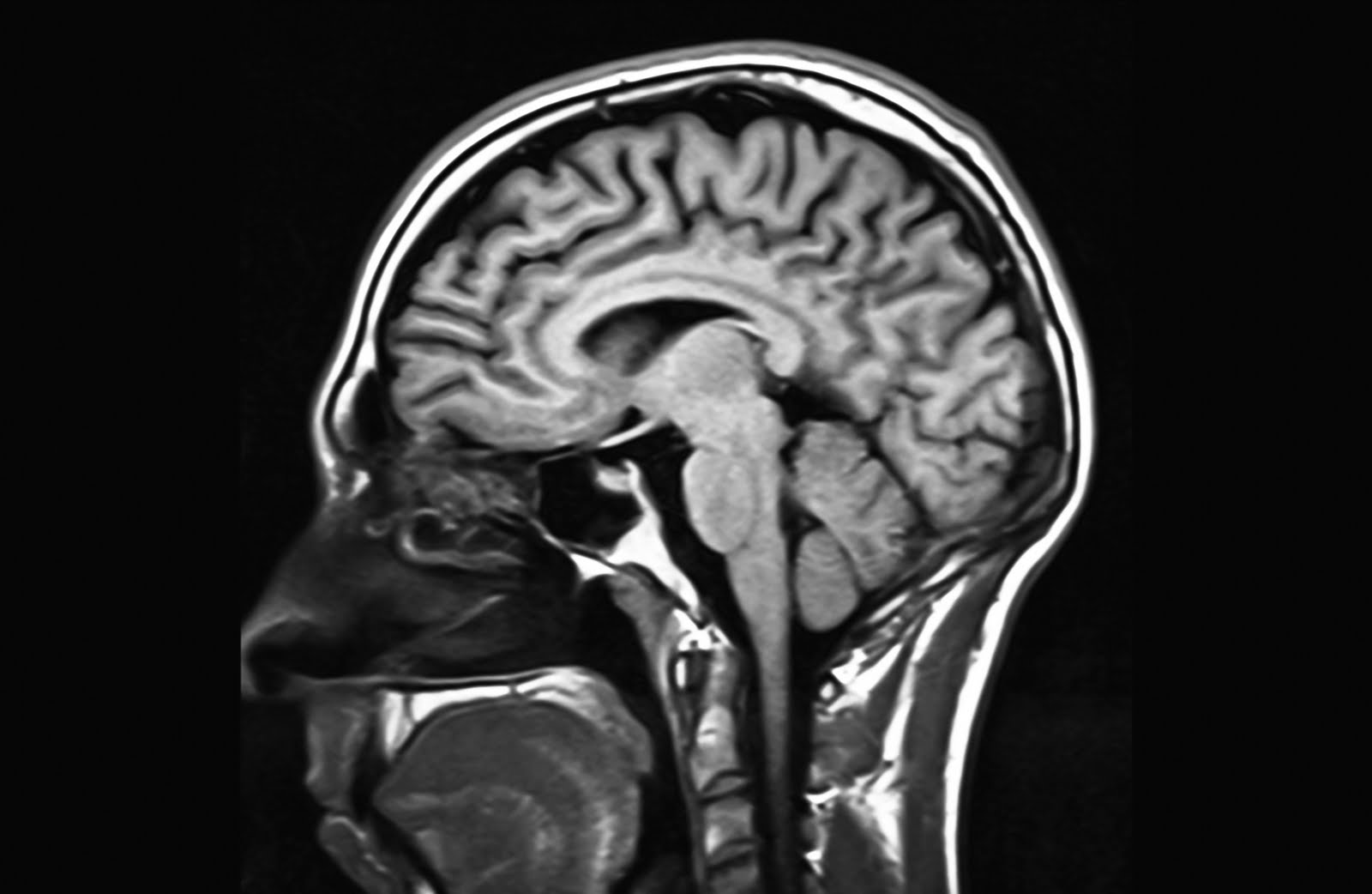 omg, get this! how i lost my hearing