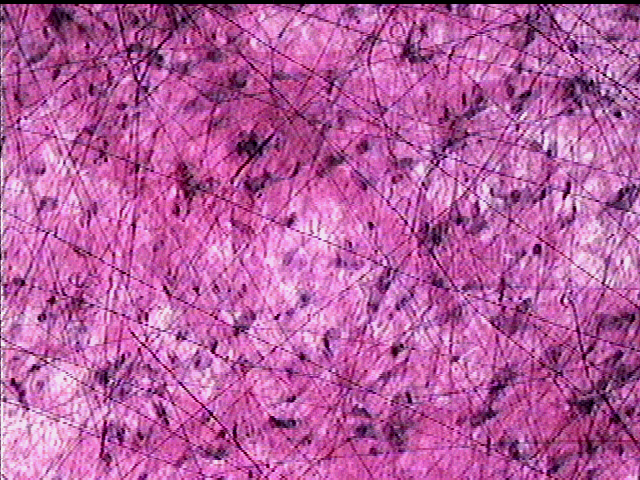 a flat fibrous sheet of connective tissue that attaches a muscle to a bone a flat fibrous sheet of connective tissue that attaches a muscle to a bone