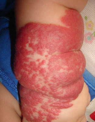 4+meses+...+peor+momento+,+casi+totalmente+rojo+,+se+va+llenando+desde+los+lados+hacia+el+centro.jpg