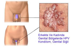 kondomsuz cinsel ilişki nedir kondomsuz cinsel ilişki nedir