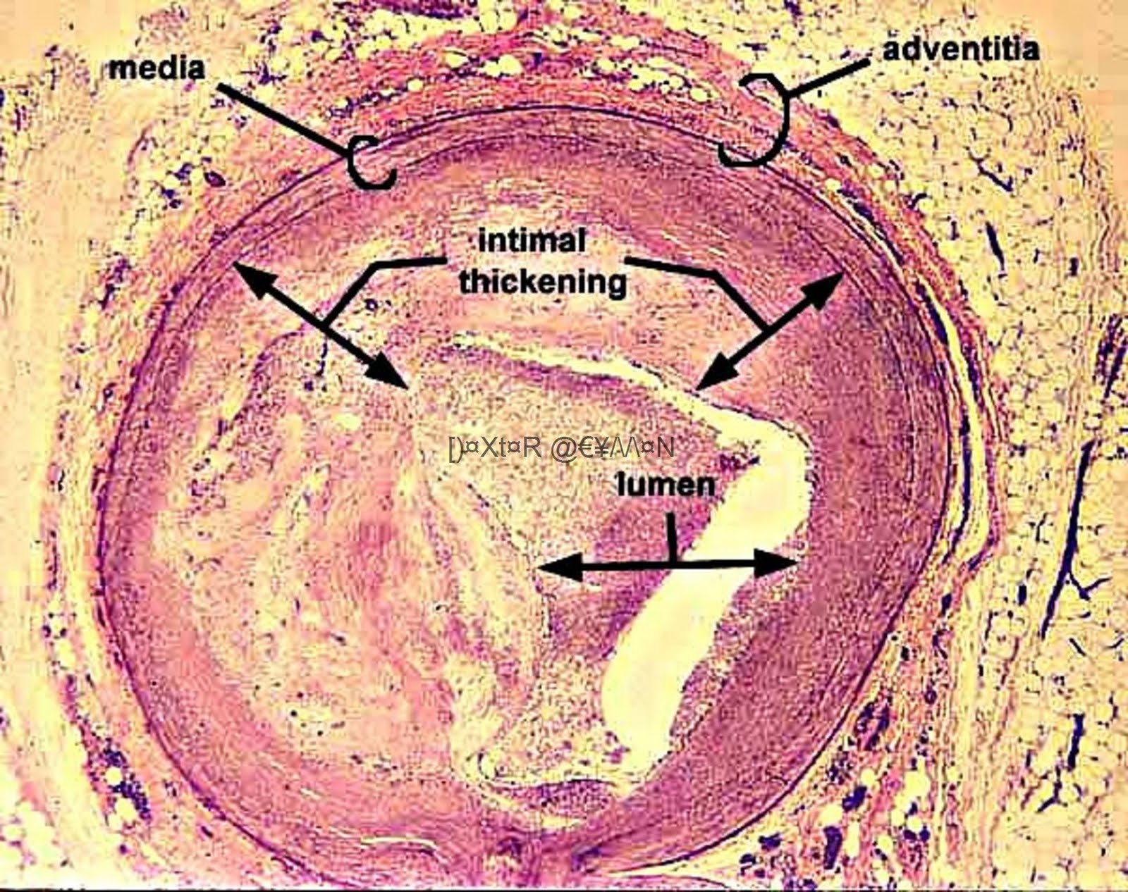 3rd-year-mbbs-pathology-slides-and-models-general-pathology-medical