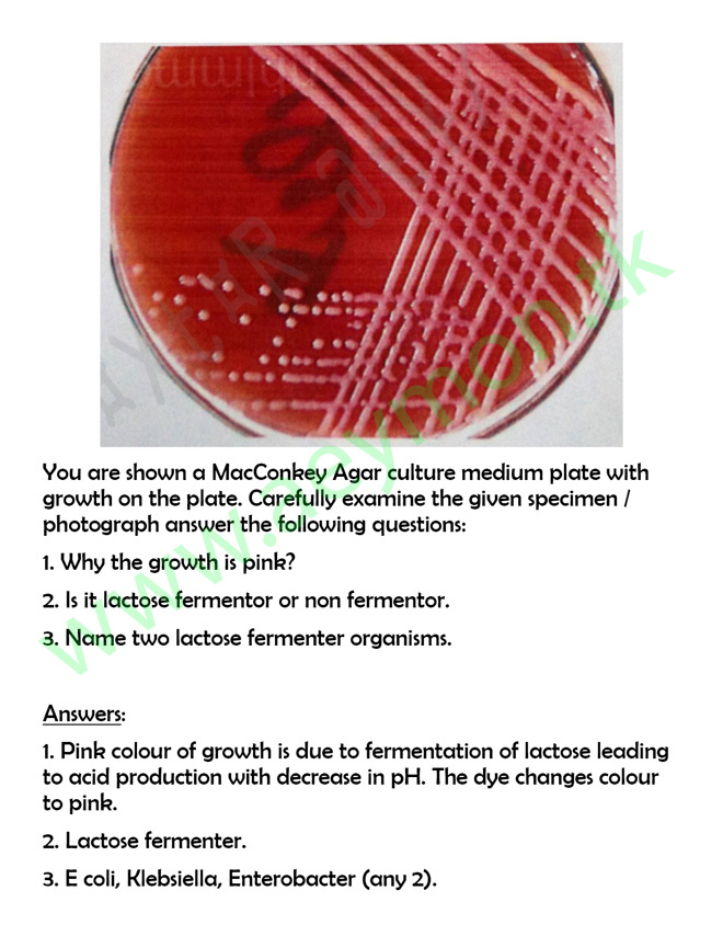3rd Year MBBS BACTERIOLOGY (pathology) OSPE by UHS Medical ebooks and