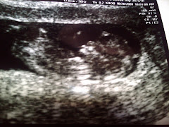 Second Ultrasound