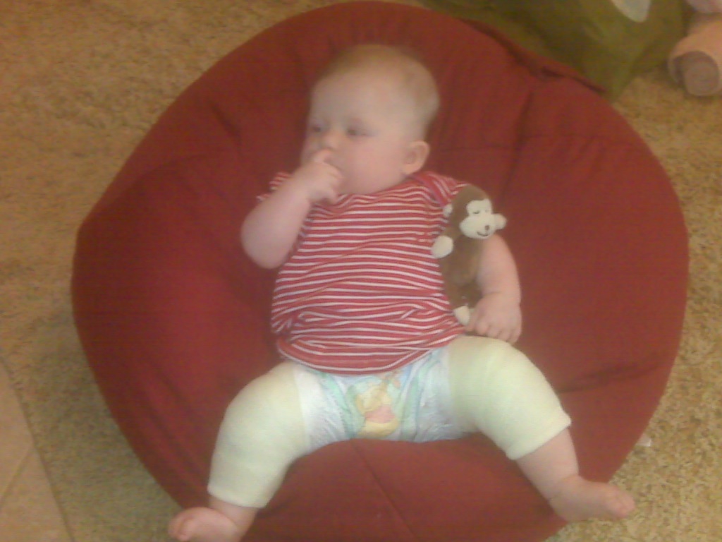 one hip blog Spica Cast info & Tips