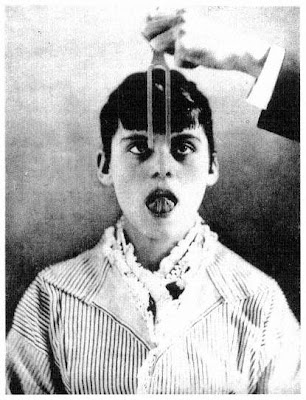 The+hypnotized+patient+and+the+tuning+fork.jpeg