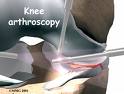 [kneesurgery.jpg]