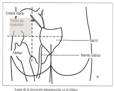 Como colocar inyeccion intramuscular en gluteo