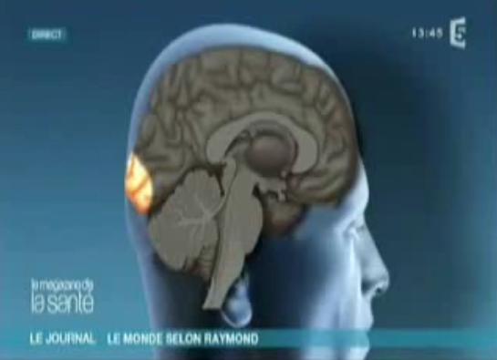 Cerveau de Raymond Domenech