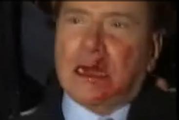 Silvio Berlusconi agression