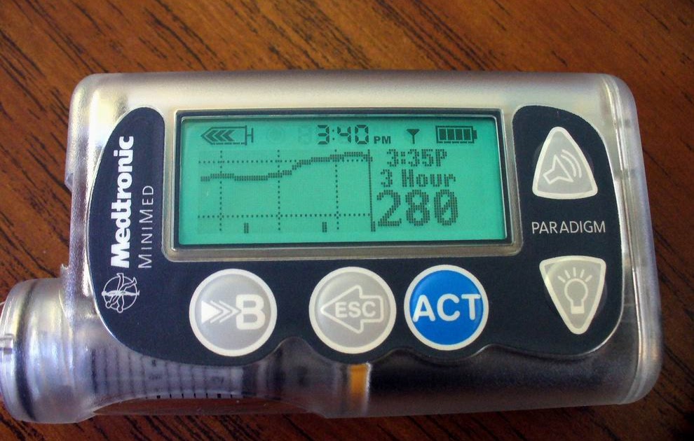 Diabetes Life Balance: Inserted—Medtronic Minimed MiniLink is Active!