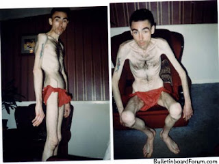 mananorexic.jpg