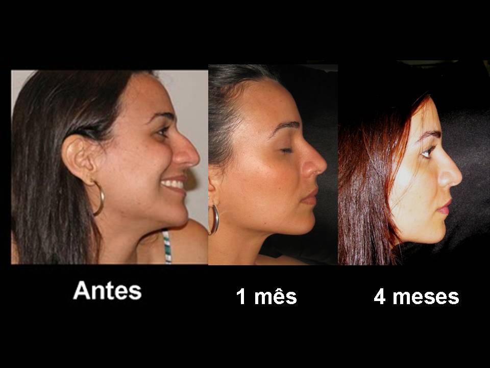 9 meses depois de muita pica 1