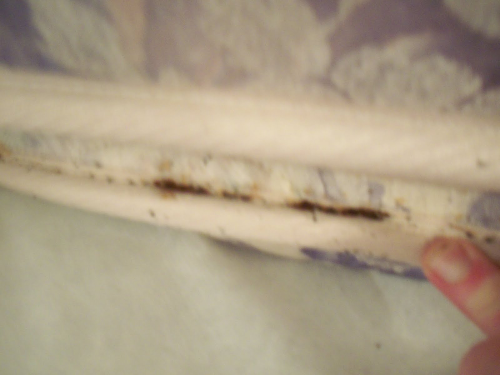 Bed Bug Bites Stomach Moreoo